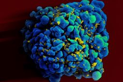 Bệnh nhân được chữa khỏi HIV nhờ ghép tế bào gốc